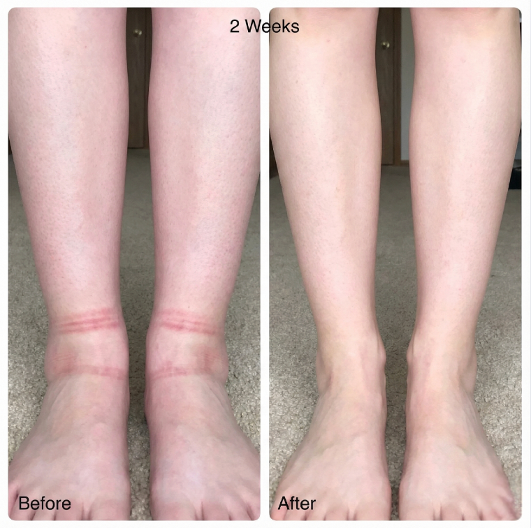 "New Fuwa.Lab RéVive EMS"