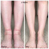 "New Fuwa.Lab RéVive EMS"